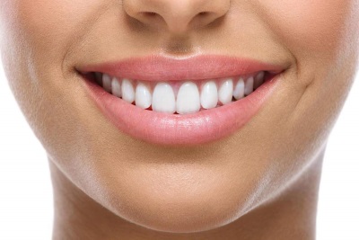esthetique dentaire