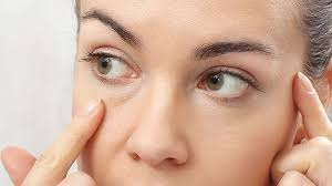 blepharoplastie-tunisie