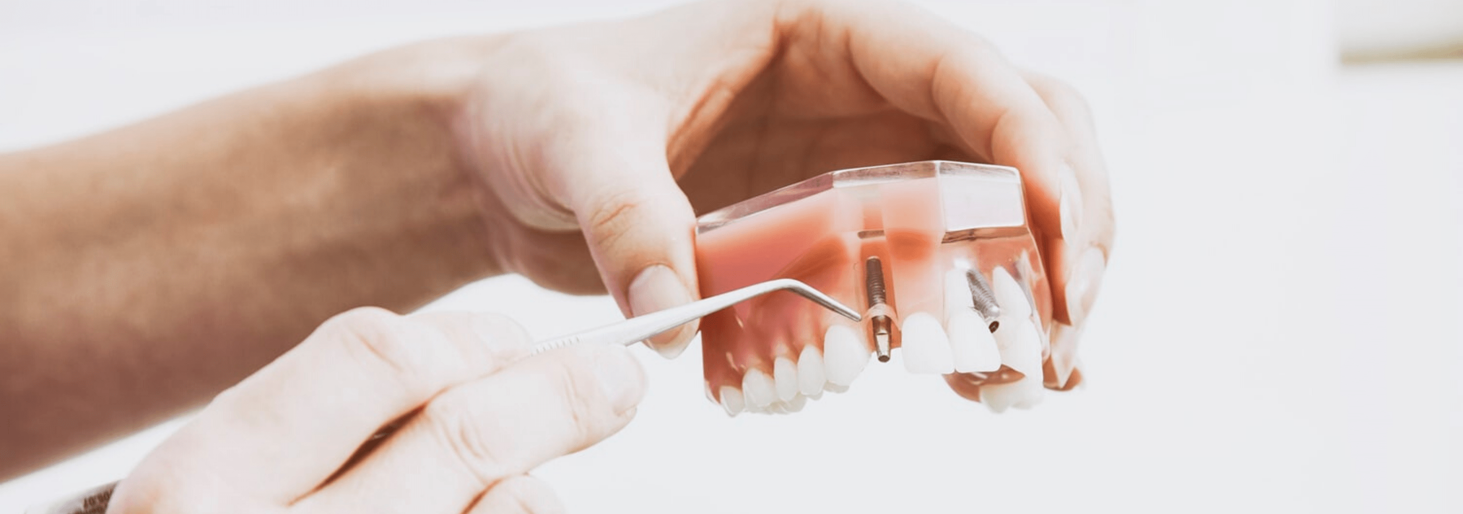 implant-dentaire-Hongrie