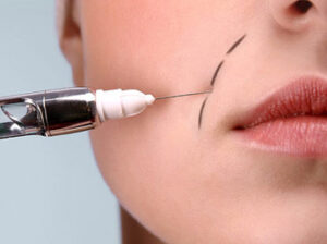 chirurgie-esthetique